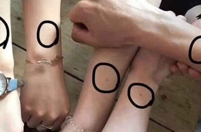  Binlerce kadın aynı noktada, aynı çilden olduğunu söylüyor: Peki, sizde var mı? Bilekteki çillerin nedeni ne?