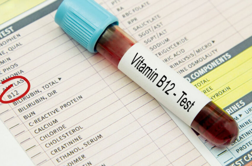 B12 vitamini eksikliği neden olur, belirtileri neler? B12 vitamini nelerde bulunur? B12 vitamini hakkında 12 soru cevap